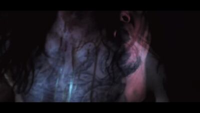 SUTURE - Carcinoma Contagion