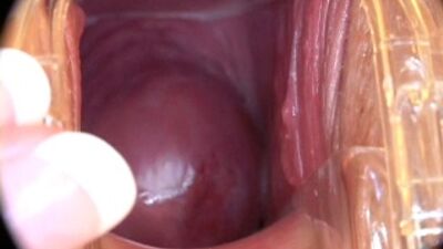 Оргазм у Девушки(Что происходит во время оргазма в внутри влагалища)