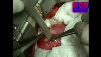 Фильм Паразиты в Организме Человека-Признаки паразитов в человеке(симптомы,лечение глистов у детей и взрослых)-Видео о паразитах