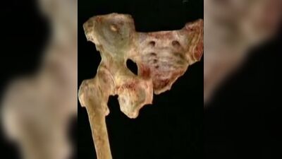 Анатомия Акланд таз и бедро перевод.