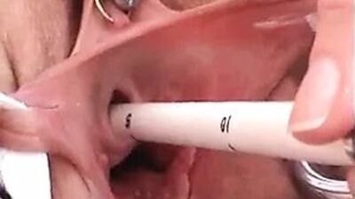 Шейка шейки матки и уретра трахаются с предметами и мастурбируют уретрой