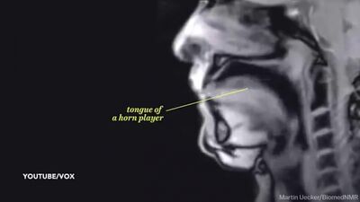 Amazing MRI scan video captures couple having sex