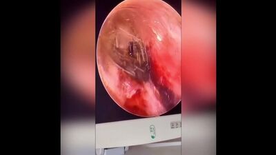 Насекомое внутри