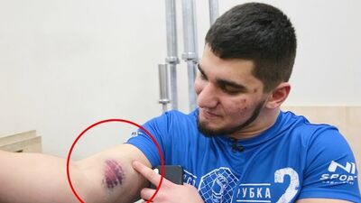 [Body Mania] Травма после боя! Тамаев vs Марвин