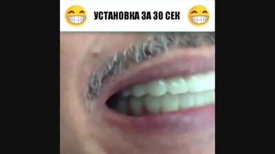 Твоя идеальная улыбка уже ЗАВТРА